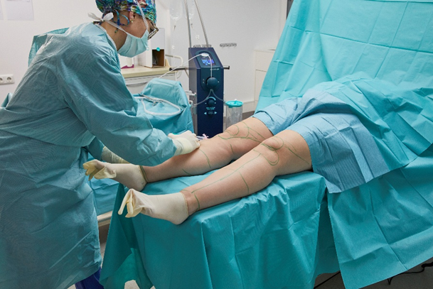 Medizinisches Personal in Schutzkleidung bereitet einen Patienten für einen chirurgischen Eingriff vor, während die Beine des Patienten auf einem Operationsbett mit blauen Tüchern bedeckt sind.